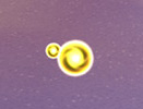 Visual difference between both orbs / Kingdom Hearts 2.5